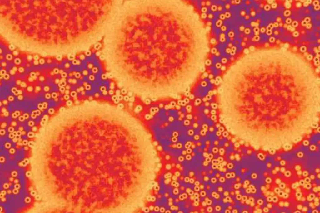 Wat je moet weten over Norovirus