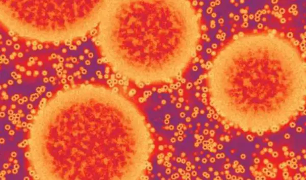 Wat je moet weten over Norovirus