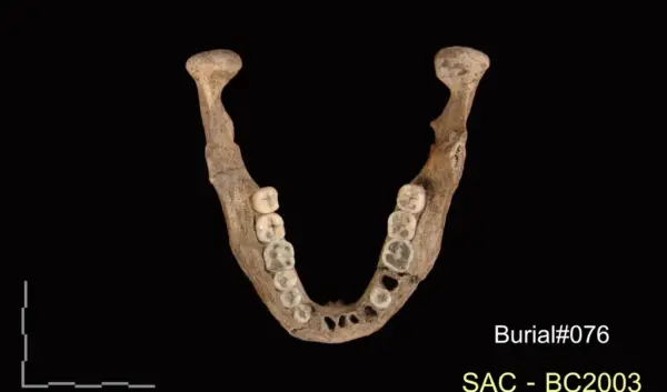 Het Belang van Skeletten in de Wetenschap en Evolutie