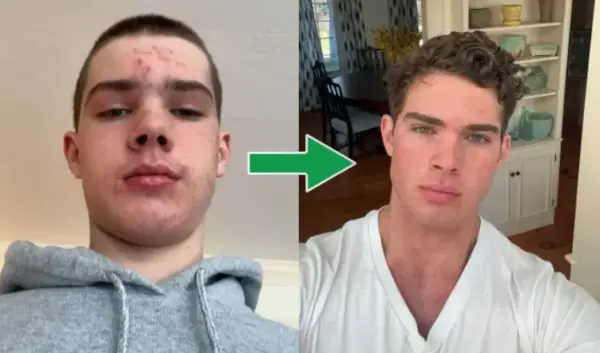 clavicular — NL news