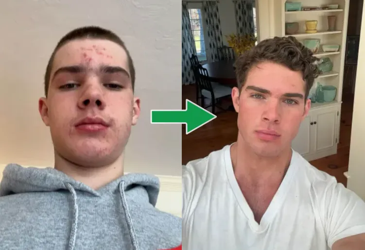 Clavicular: Braden Eric Peters gearresteerd in Fort Lauderdale