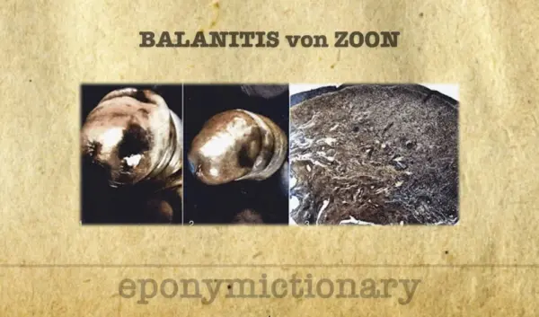 zoon — NL news